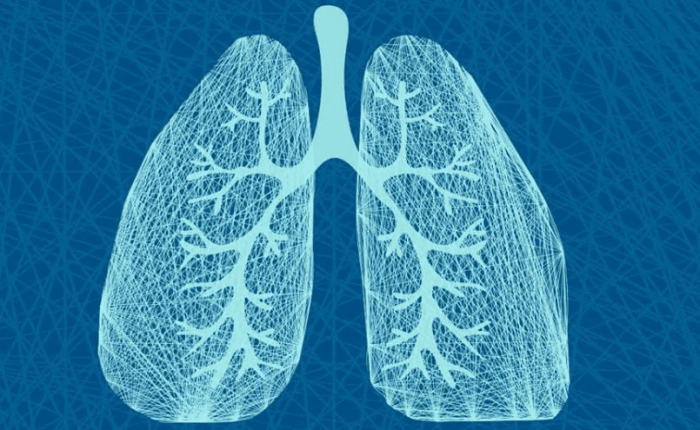 肺結節,肺結節前兆,肺結節原因,肺結節症狀,肺結節治療,肺結節飲食,預防,禁忌