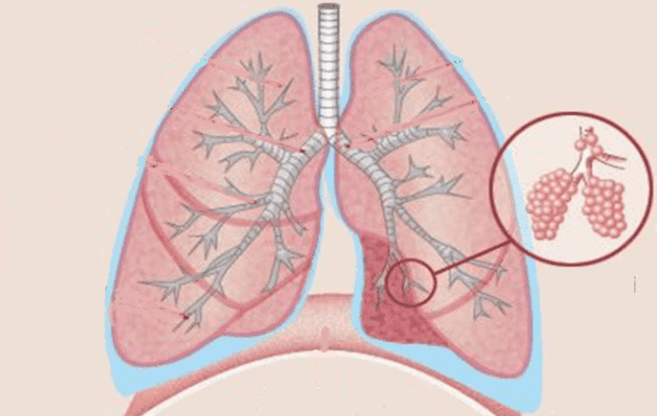 肺結節症狀,肺結節是什麼,肺結節高危險族群,肺結節治療,肺結節預防,肺結節禁忌