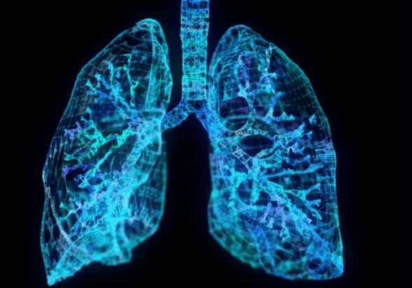 肺結節原因,肺結節症狀,肺結節診斷,肺結節檢查,肺結節治療,肺結節預後