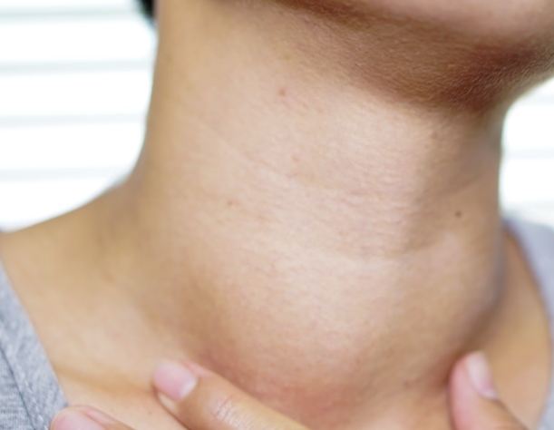 甲狀腺結節腫症狀全解析：病因、就醫科別、飲食禁忌及治療方法一次看懂