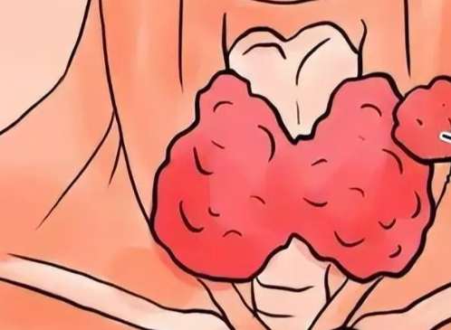 甲狀腺開刀復原期