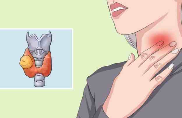 甲狀腺結節術後恢復